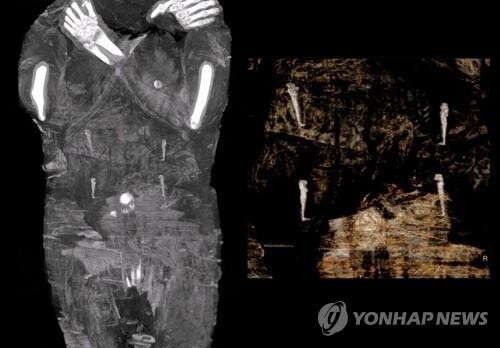 "임신부 미라 처음 아냐" 이집트 저명학자, 폴란드 연구진 반박
