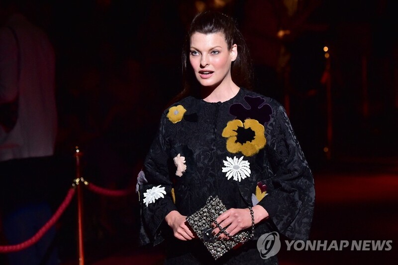 "성형수술 실패로 은둔자 생활"…전설적 슈퍼모델 눈물의 호소