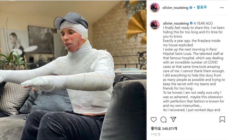 "폭풍 뒤엔 태양 있다" 발망 수석디자이너, 화상 흉터 고백