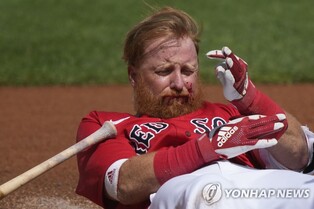 MLB 터너, 얼굴에 투구 맞고 16바늘 봉합…"골절은 없어"