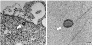 S. Korea reports 2 more local mpox infections