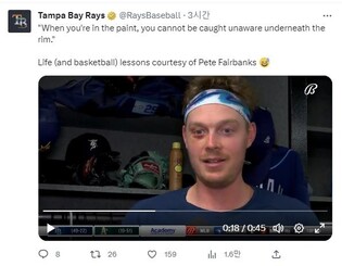 멍든 눈으로 돌아온 MLB 투수 "3살 아들과 농구하다가…"