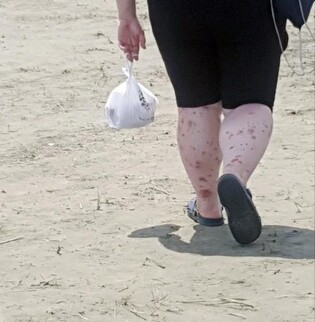 잼버리 학부모들 "더위·벌레에 힘들어 해…냉수 공급은 하세월"(종합)