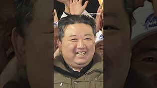 Kim Jong-un's white hair...