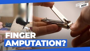 Nail trimming by caregiver leads to bleeding, tissue death