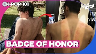 Let's find out why V has red marks on his back